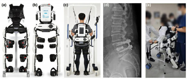 로봇 보조 보행 훈련 개념 설명 사진. (a) 보행 보조 훈련 로봇 전면 및 (b) 후면. (c) 로봇을 활용해 보행 보조 훈련 중인 환자 후면. (d) 측면 요추 방사선 사진과 (e)척추 보조기를 착용하고 보행 보조 로봇 훈련을 받는 환자 모습. /사진=강남세브란스병원